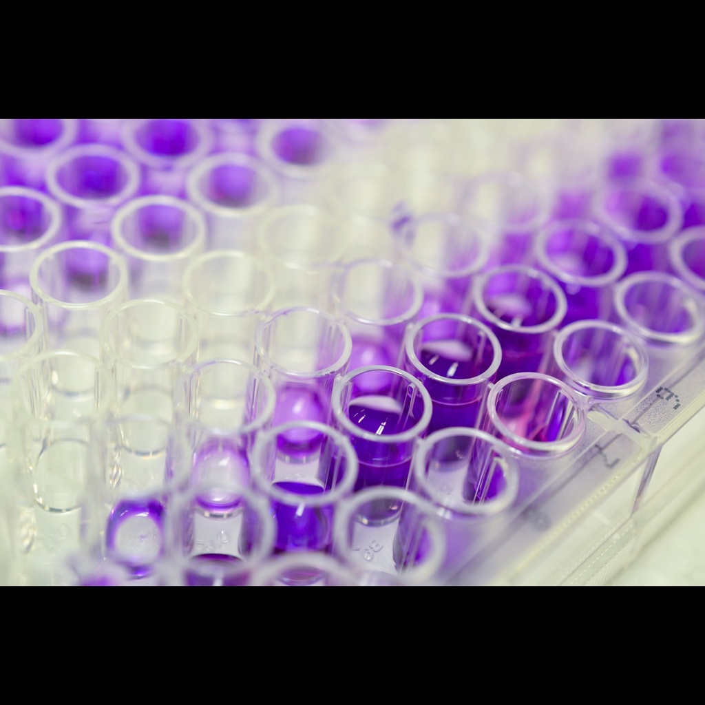 NRF2 elisa kit :: Mouse Nuclear factor erythroid 2size:related factor 2, NRF2 ELISA Kitsize:96size:Stripsize:Wells